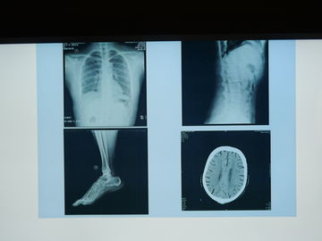 Agfa Yazıcı için Suya Dayanıklı Konida X Ray Tıbbi Görüntüleme Filmi