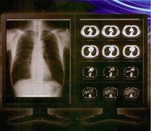 Parlak Net Dijital Röntgen Filmi, Konida Tıbbi Lazer Şeffaf Film