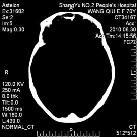 Fuji Yazıcı için 10 x 14 X-ray Tıbbi Kuru Görüntüleme Filmi Duyarlı Termal