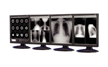 Tıbbi görüntüleme ekipmanında kullanılan yansıma önleyici tıbbi sınıf ekranlar