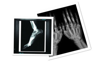 Hosipital PET Film Tıbbi X Ray Kağıdı Su Geçirmez 8 × 10 İnç CT Film Beyaz