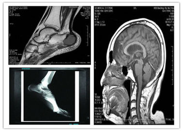 Tıbbi Dijital Mavi Baz Kuru Görüntüleme Filmi 8x10in Uyumlu Hosipital MRI Tarama