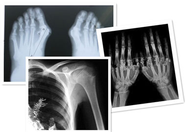 Radyografi Muayenesi İçin Termal Dijital Röntgen Filmi Fuji Medikal