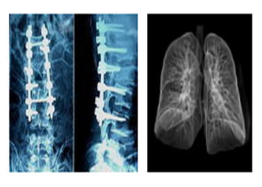 Keskin Radyografik Tıbbi Röntgen Filmleri, MRI Dr Ct Dijital Kuru Görüntüleme Filmi