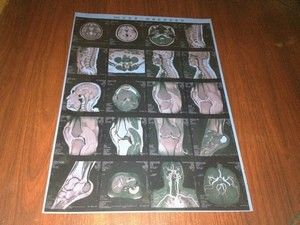 Good price Düşük Sis Tıbbi X Ray Filmleri, Yüksek Netlik Konida X-ray Kuru Film çevrimiçi