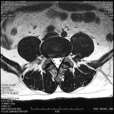 İyi bir fiyat. KND-A Düşük Sis Tıbbi Kuru Görüntüleme Filmi XFA Muayene Için AGFA 5300 11in × 14in çevrimiçi