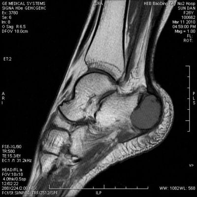 İyi bir fiyat. Termal Yazıcılarla Uyumlu KND-A Yüksek Maksimum Yoğunluklu Tıbbi Kuru Görüntüleme Filmi çevrimiçi