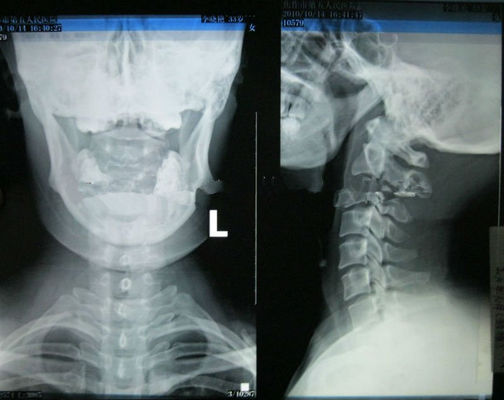 İyi bir fiyat. Lazer Yazıcı İçin Yüksek Netlik Giyilebilir Konida Tıbbi Görüntüleme Xray Kağıdı çevrimiçi