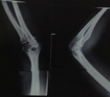 İyi bir fiyat. Lazer Yazıcılar için Su Geçirmez X Ray Teşhis Görüntüleme Tıbbi Kağıt KND-K çevrimiçi