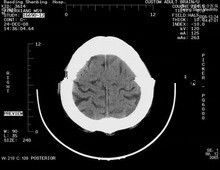 İyi bir fiyat. Konida Lazer Yazıcılar için 8 x 10 Çizilmeye dayanıklı Tıbbi Kağıt Xray Filmleri çevrimiçi