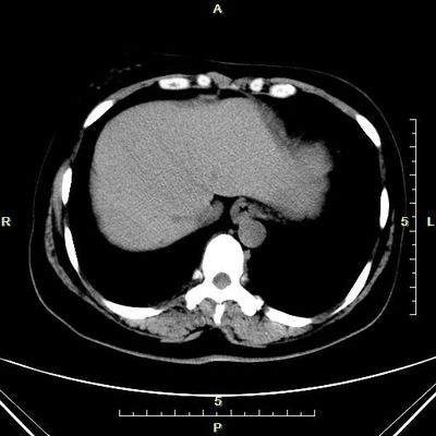 İyi bir fiyat. Xray Makinesi İçin İnce Konida X Ray Teşhis Görüntüleme Lazer Mavi Kağıdı çevrimiçi