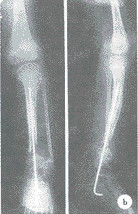 İyi bir fiyat. AGFA / Fuji için Suya Dayanıklı Kuru Tıbbi X Ray Filmleri Konida Parlak çevrimiçi