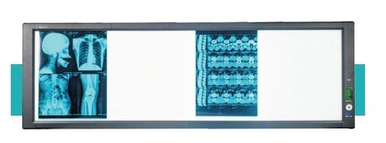 İyi bir fiyat. LED tıbbi süper parlak görüntüleme kutusu çevrimiçi