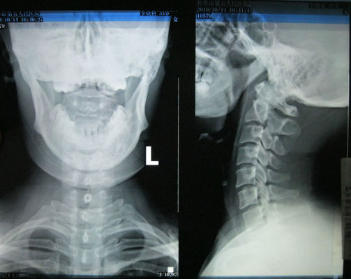 İyi bir fiyat. 35 cm * 43 cm Parlak Tıbbi Kuru Görüntüleme Filmi Fuji 3000, 2000, 1000, Termal Yazıcı çevrimiçi