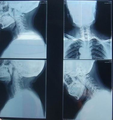 İyi bir fiyat. Radyografik Muayene için KND-K Çizilmeye dayanıklı Tıbbi Kağıt Kuru Görüntüleme Filmi çevrimiçi