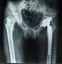 İyi bir fiyat. Termal Yazıcı İçin Düşük Sis Mavimsi Polyester Taban Konida Tıbbi Kuru Görüntüleme Filmi 28cm * 35cm çevrimiçi