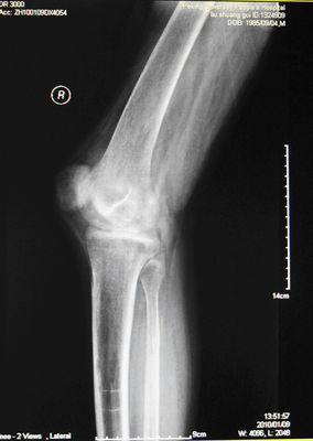 İyi bir fiyat. AGFA 5300, 5302, 5500 Üzerinde X Ray Muayenesi için KND-A Düşük Sisli Tıbbi Kuru Görüntüleme Filmi çevrimiçi