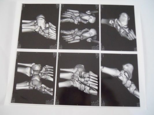 İyi bir fiyat. AGFA 5300, 5302, 5500 Üzerinde X Ray Muayenesi İçin Tıbbi Kuru Görüntüleme Filmi çevrimiçi