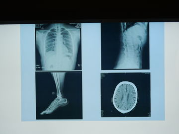 Good price Agfa Yazıcı için Suya Dayanıklı Konida X Ray Tıbbi Görüntüleme Filmi çevrimiçi