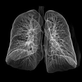 Good price CT / DR için Yüksek Netlik Tıbbi X-Ray Film Lazer Konida çevrimiçi