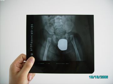 Good price Gümüş Halide Lazer X Ray Tıbbi Görüntüleme Su Geçirmez Ince Agfa DRYSTAR DT1B / DT2B çevrimiçi