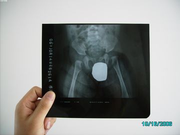 Gümüş Halide Lazer X Ray Tıbbi Görüntüleme Su Geçirmez Ince Agfa DRYSTAR DT1B / DT2B