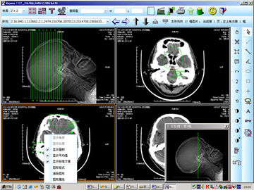 KND-DRYTEC 4000 için 8x10 inç Tıbbi Kağıt Lazer X Ray Teşhis Görüntüleme