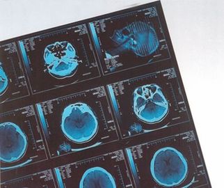 Good price Hastane CR / DR için Dijital Tıbbi X Ray Kuru Film Termal çevrimiçi
