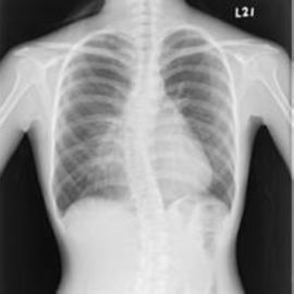 Giyilebilir Beyaz Taban Tıbbi Röntgen Filmleri, Tıbbi Görüntüleme X-ışını Kağıt Filmi