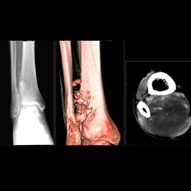 Giyilebilir Beyaz Taban Tıbbi Röntgen Filmleri, Tıbbi Görüntüleme X-ışını Kağıt Filmi
