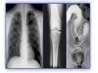 Good price Holografik Tıbbi Görüntüleme Filmi, Termal Yazıcılar PET X Ray Filmi çevrimiçi