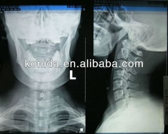 Good price Yüksek Netlikli Tıbbi Tanı Görüntüleme, Kuru AGFA X Ray Filmi çevrimiçi