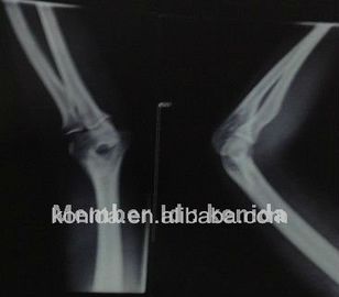 Şeffaflık Dijital Röntgen Filmi, Tıbbi Görüntüleme AGFA / Fuji Röntgen Kuru Filmi