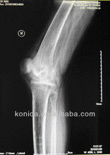 Good price Dayanıklı X Ray Teşhis Görüntüleme, 32 cm x 43 cm Tıbbi Kağıt Lazer Mavi X Ray Filmi çevrimiçi