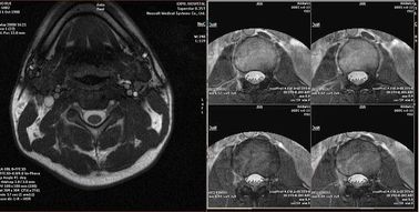 CT Makinesi ile Çevre Dostu Tıbbi Kuru Film Agfa 2B X Ray