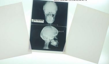 Good price Lazer Yazıcı için Parçalanabilir Beyaz Taban Xray Kağıt Tıbbi Film çevrimiçi