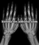 Agfa / Fuji için Çift Katmanlı Tıbbi X Ray Termal Yazıcı Filmi 14 x 17