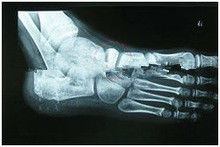 Good price Lazer Yazıcı için 13in x 17in Degradable X Ray Teşhis Görüntüleme Tıbbi Kağıt çevrimiçi