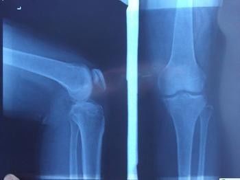 Good price Mavi X Ray Teşhis Görüntüleme, Tıbbi Lazer Kağıdı Xray Fotoğraf Filmi çevrimiçi