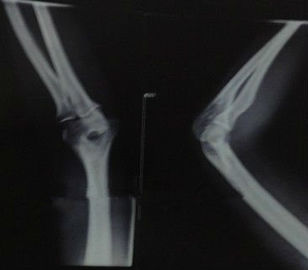 Good price Lazer Yazıcılar için Su Geçirmez X Ray Teşhis Görüntüleme Tıbbi Kağıt KND-K çevrimiçi