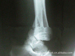 Good price Beyaz Kağıt Lazer X Ray Tıbbi Görüntüleme 8in x 10in Su Geçirmez çevrimiçi