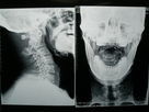 Good price Fuji / Agfa Yazıcılar için Konida Medical Kuru Görüntüleme Filmi Dijital X-ray çevrimiçi