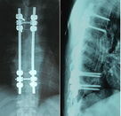 Agfa / Fuji için X Ray Kuru Tıbbi Görüntüleme Filmi Mavi 8 x 10 İnç