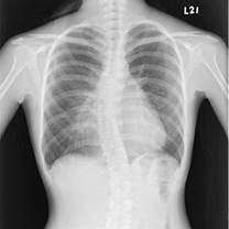 Good price 10 x 12 inç X Ray Tıbbi Görüntüleme çevrimiçi