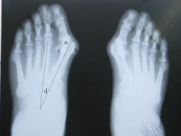 Good price Su Geçirmez X Ray Teşhis Görüntüleme çevrimiçi
