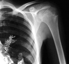 Agfa / Fuji Tıbbi X-Ray Filmi, Radyografi Taşınabilir Lazer Yazıcı Filmi