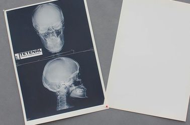 Parçalanabilir Beyaz Taban PET Malzeme X ışını Kağıt Medikal Film