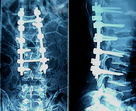 X Ray Muayenesi İçin Konida Düşük Sisli Tıbbi Kuru Görüntüleme Filmi