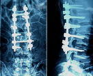 Good price X Ray Muayenesi İçin Konida Düşük Sisli Tıbbi Kuru Görüntüleme Filmi çevrimiçi