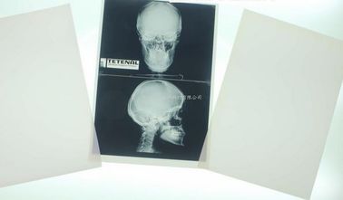 Konida 10 inç X 12 inç Röntgen Tıbbi Görüntüleme